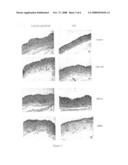 Mucoadhesive Pharmaceutical Compositions Comprising Chemoattractants diagram and image