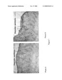 Angiogenic composition diagram and image