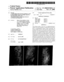 Use of 2,5-Dihydroxybenzenesulphonic Acid in the Production of Medicaments for the Treatment of Angiodependent Diseases Such as Cancer and Psoriasis diagram and image