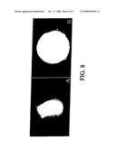 Use of 2,5-Dihydroxybenzenesulphonic Acid in the Production of Medicaments for the Treatment of Angiodependent Diseases Such as Cancer and Psoriasis diagram and image