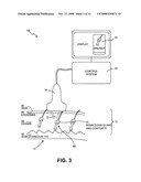 METHOD AND SYSEM FOR NON-ABLATIVE ACNE TREATMENT AND PREVENTION diagram and image