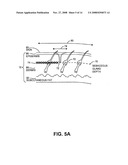 METHOD AND SYSEM FOR NON-ABLATIVE ACNE TREATMENT AND PREVENTION diagram and image