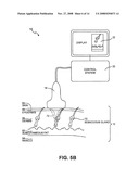 METHOD AND SYSEM FOR NON-ABLATIVE ACNE TREATMENT AND PREVENTION diagram and image