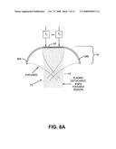 METHOD AND SYSEM FOR NON-ABLATIVE ACNE TREATMENT AND PREVENTION diagram and image