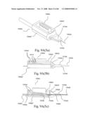 Delivery of Agents Such as Cells to Tissue diagram and image