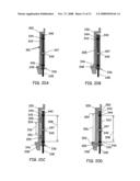 Touch Sensing Catheter diagram and image