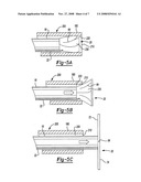 Electrical cautery device diagram and image