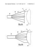 Electrical cautery device diagram and image