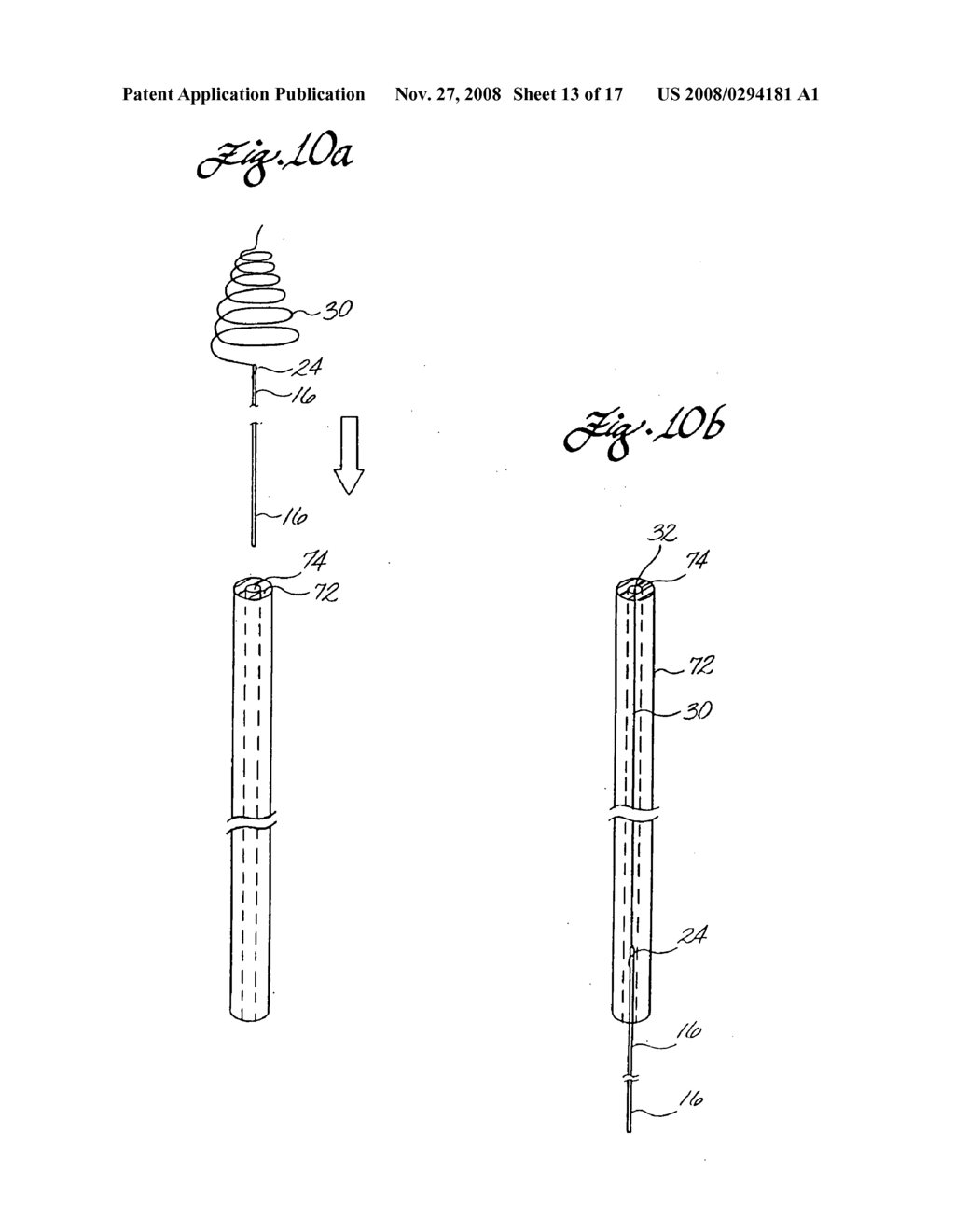 Clot capture coil - diagram, schematic, and image 14