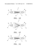 Implant Holder and Method of Deploying the Implant diagram and image