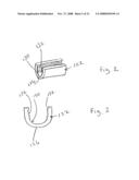 Spinous process implants and methods of using the same diagram and image