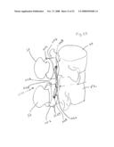 Spinous process implants and methods of using the same diagram and image