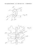 Spinous process implants and methods of using the same diagram and image