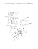 Spinous process implants and methods of using the same diagram and image