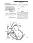 LOCATION, TIME, AND/OR PRESSURE DETERMINING DEVICES, SYSTEMS, AND METHODS FOR DEPLOYMENT OF LESION-EXCLUDING HEART IMPLANTS FOR TREATMENT OF CARDIAC HEART FAILURE AND OTHER DISEASE STATES diagram and image