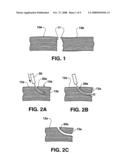 Methods and Materials for Connective Tissue Repair diagram and image