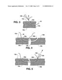 Methods and Materials for Connective Tissue Repair diagram and image