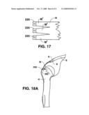 Methods and Materials for Connective Tissue Repair diagram and image