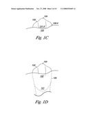 Tooth modeling diagram and image