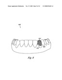 Tooth modeling diagram and image