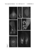 Soybean promoters LTP2 and flower-preferred expression thereof in transgenic plants diagram and image