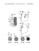 BRIDGE ELEMENT FOR LUNG IMPLANT diagram and image
