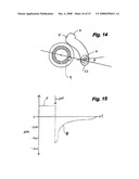Cam-Actuated Centrifugal Brake for Preventing Backspin diagram and image