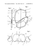 Airbag for Protecting a Vehicle Occupant diagram and image