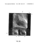 METHOD AND SYSTEM OF PREVIEWING PREVIOUS AND FORWARD FRAMES OF A SELECTED END OF DIASTOLE OR END OF SYSTOLE FRAME CANDIDATE diagram and image