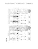 Computer-Aided Method for Detection of Interval Changes in Successive Whole-Body Bone Scans and Related Computer Program Program Product and System diagram and image