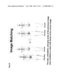 Computer-Aided Method for Detection of Interval Changes in Successive Whole-Body Bone Scans and Related Computer Program Program Product and System diagram and image