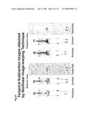 Computer-Aided Method for Detection of Interval Changes in Successive Whole-Body Bone Scans and Related Computer Program Program Product and System diagram and image