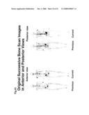 Computer-Aided Method for Detection of Interval Changes in Successive Whole-Body Bone Scans and Related Computer Program Program Product and System diagram and image