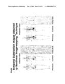 Computer-Aided Method for Detection of Interval Changes in Successive Whole-Body Bone Scans and Related Computer Program Program Product and System diagram and image