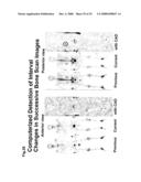 Computer-Aided Method for Detection of Interval Changes in Successive Whole-Body Bone Scans and Related Computer Program Program Product and System diagram and image