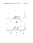 Method of Processing a Container and Base Cup Structure for Removal of Vacuum Pressure diagram and image