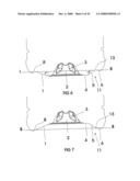 Method of Processing a Container and Base Cup Structure for Removal of Vacuum Pressure diagram and image