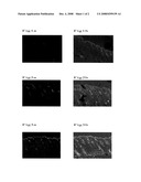 Anti-acne skin agent for external use diagram and image