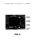 Intervertebral Disc Repair, Methods and Devices Therefor diagram and image