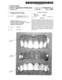 METHOD AND APPARATUS FOR TEMPORARY DENTAL VENEERS diagram and image