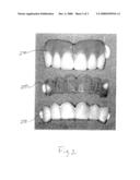 METHOD AND APPARATUS FOR TEMPORARY DENTAL VENEERS diagram and image