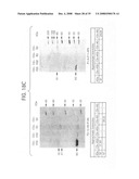 Compositions and methods for diagnosis and treatment for type 2 diabetes diagram and image