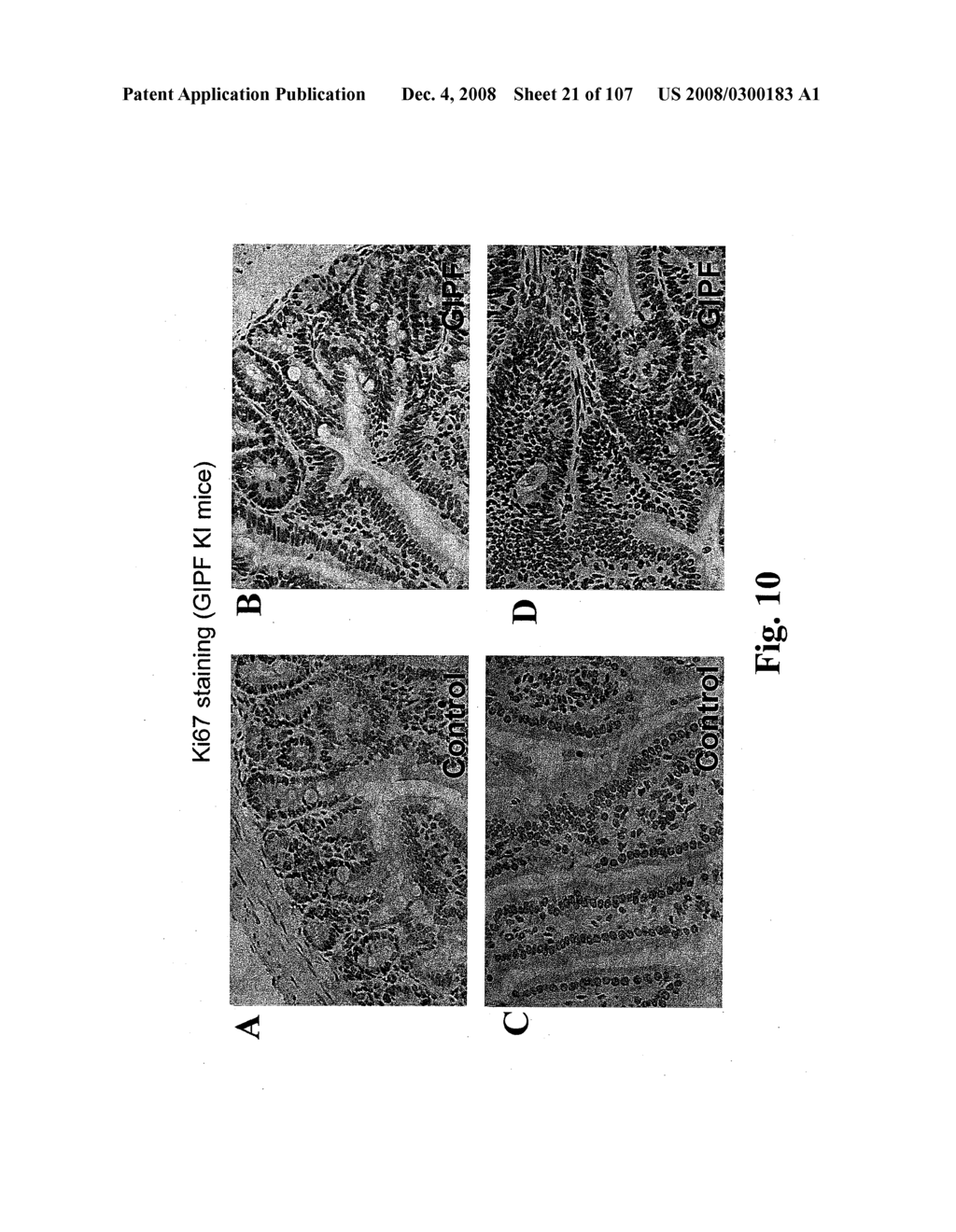 Gastrointestinal proliferative factor and uses thereof - diagram, schematic, and image 22