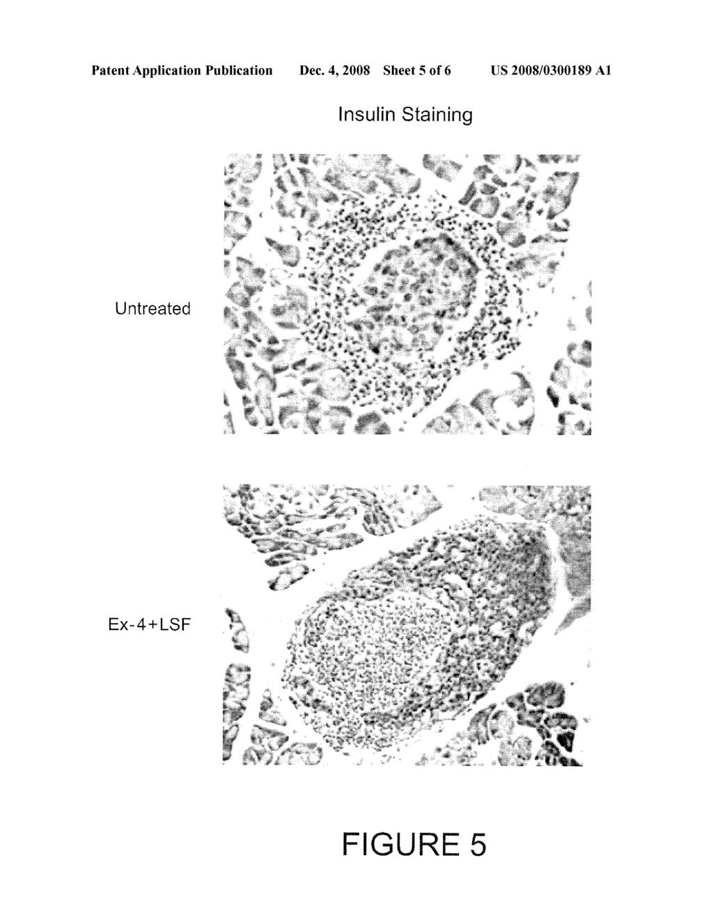 PHARMACEUTICAL COMPOSITIONS AND METHODS FOR RESTORING BETA-CELL MASS AND FUNCTION - diagram, schematic, and image 06