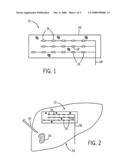 Dynamic reference method and system for use with surgical procedures diagram and image