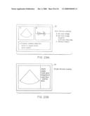 Portable ultrasound imaging system diagram and image