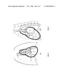 IMPLANTABLE MEDICAL DEVICES EVALUATING THORAX IMPEDANCE diagram and image