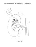 METHOD AND APPARATUS FOR DELIVERING AN AGENT TO A KIDNEY diagram and image