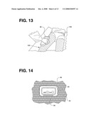 Telemetric Orthopaedic Implant diagram and image