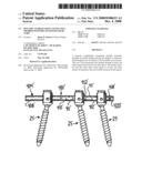 Dynamic stabilization connecting member with pre-tensioned solid core diagram and image